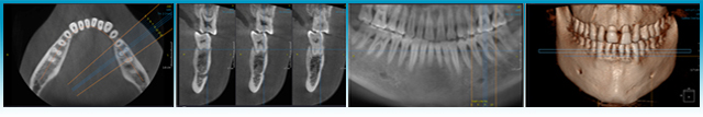 Radiología